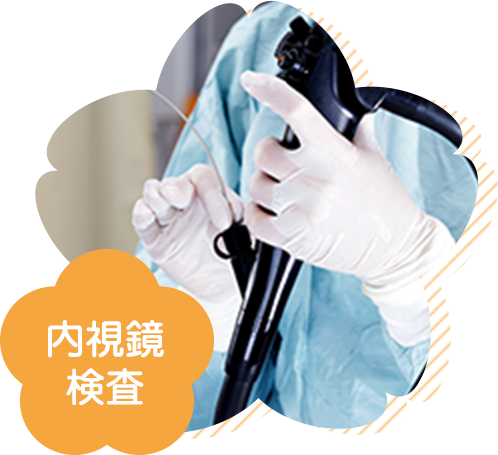 内視鏡検査